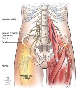 lumbar spine | pelvis | Femur | Affected area of thigh